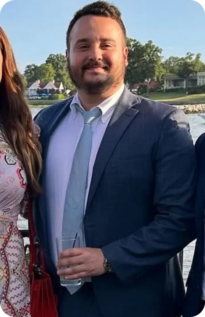 Rob before weight loss treatment